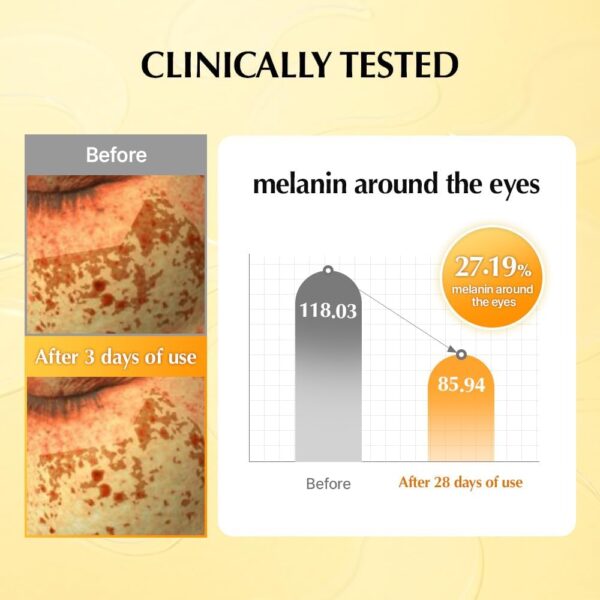 UIQ Biome Vita C Dark Circle Eye Patch