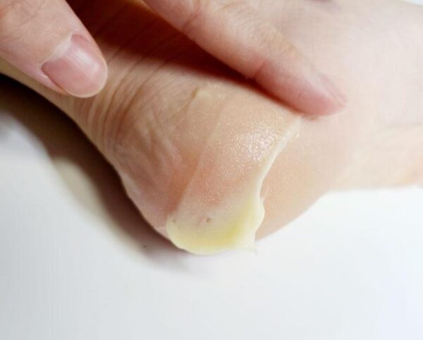 MEDI-PEEL EGF Scaling Moisture Foot Cream 2.0 130gr